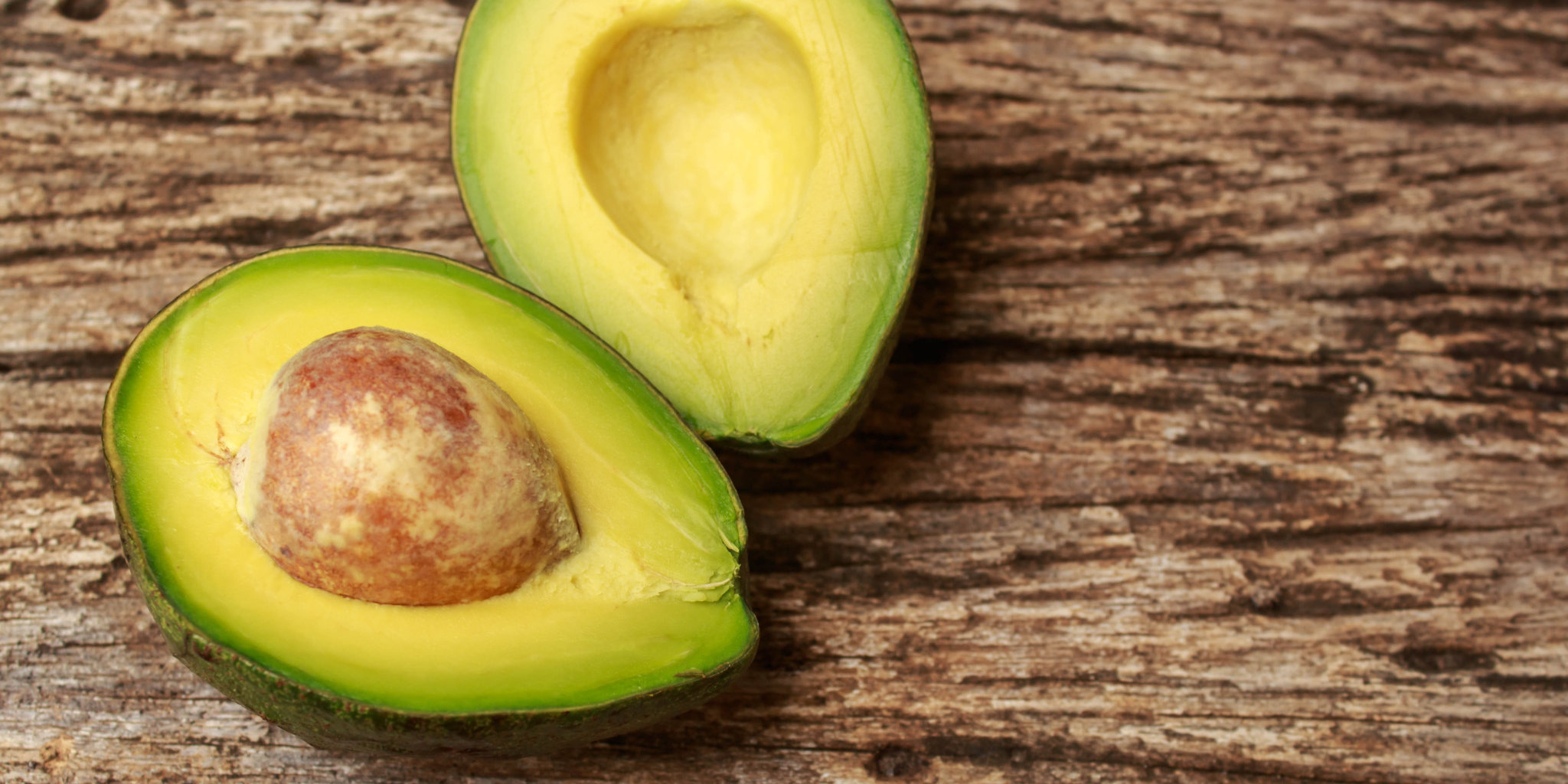 ThinkstockPhotos  Avocado